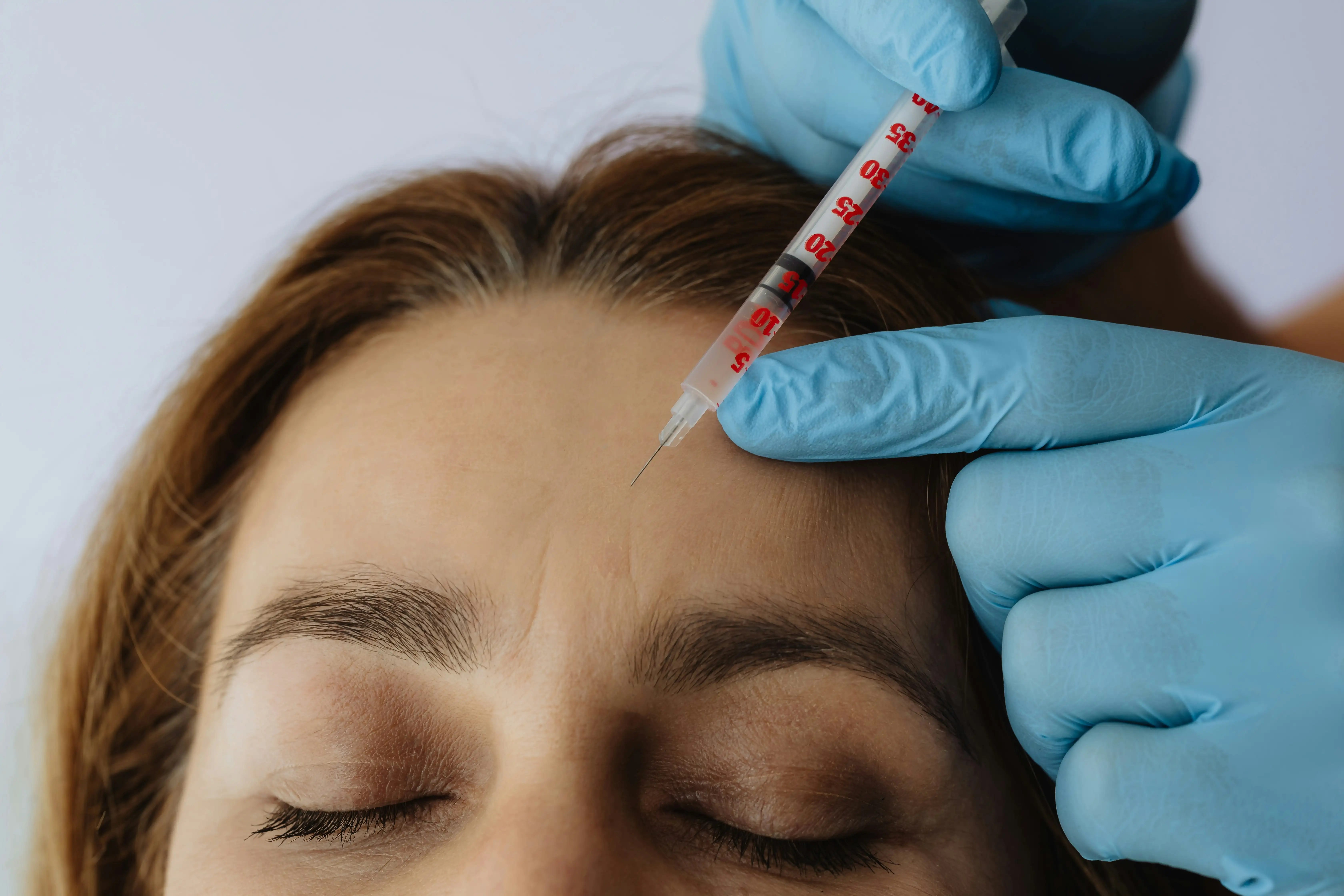 Ästhetische Botox-Behandlung