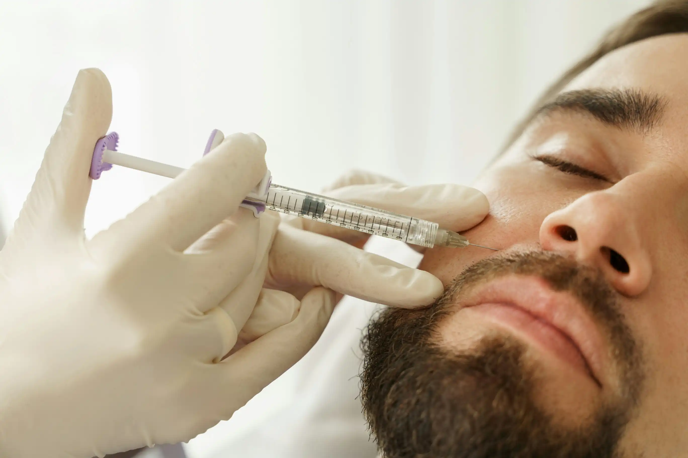 Hyaluronsäure Behandlung World of Aesthetic Prof. Dr. Christian Weinand Hamburg