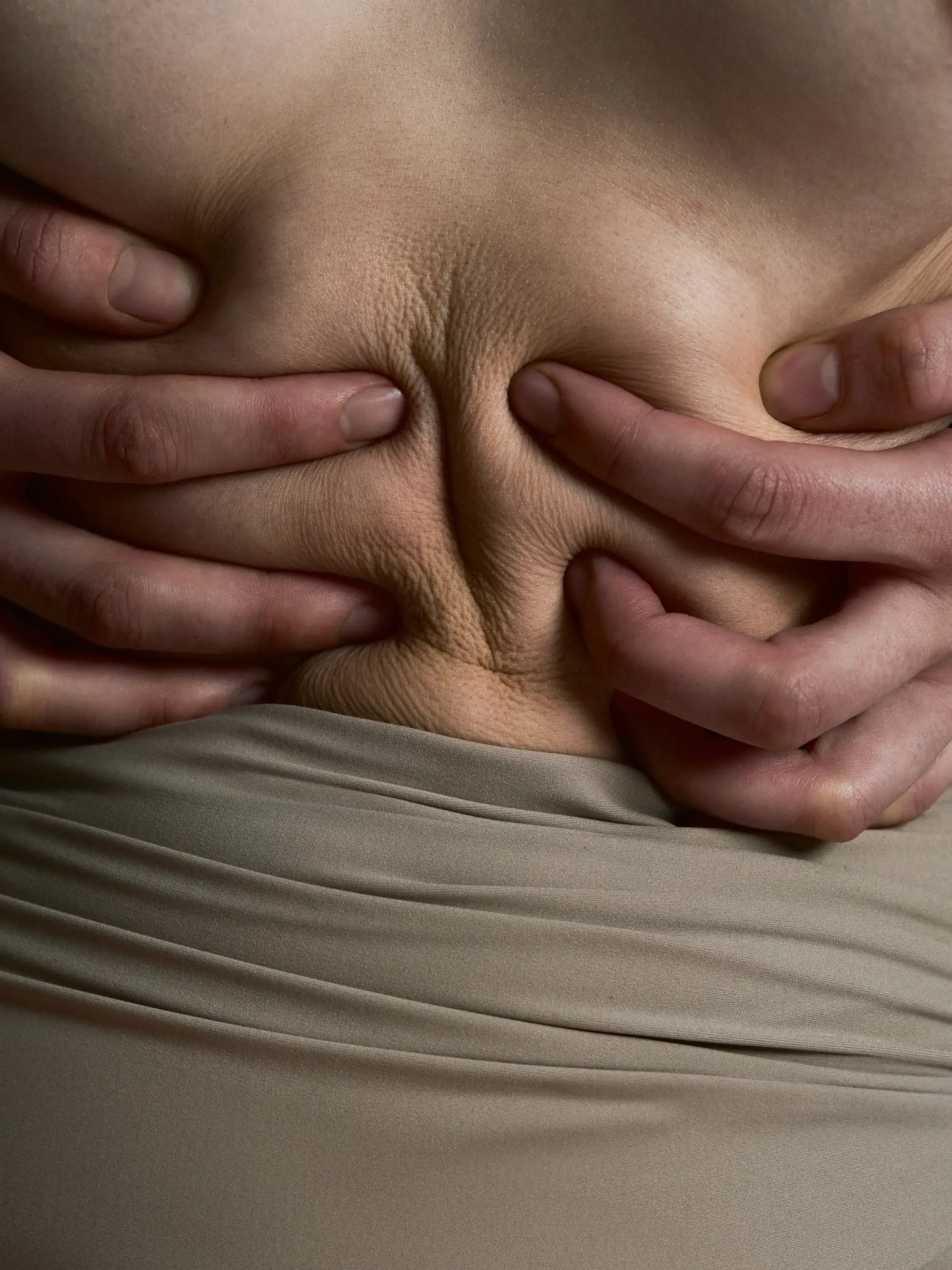 Bauchstraffung World of Aesthetic Prof. Dr. Christian Weinand Hamburg